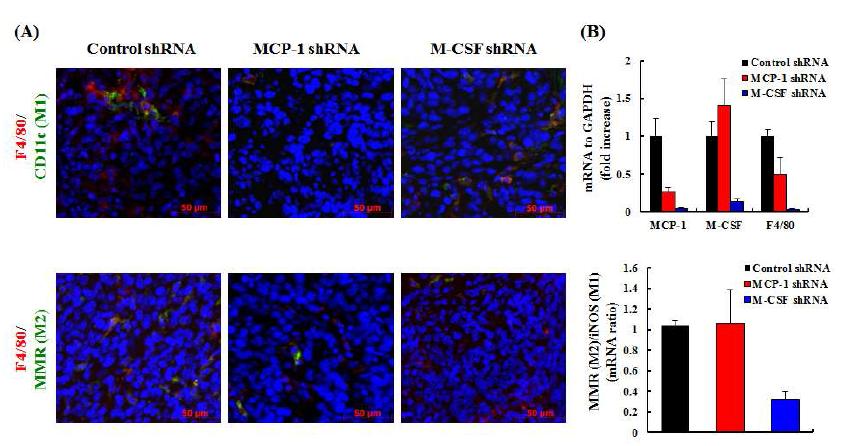암세포에서의 MCP-1 혹은 M-CSF의 발현 억제가 종양 조직에서의 대식세포의 유입 및 polarity의 변화