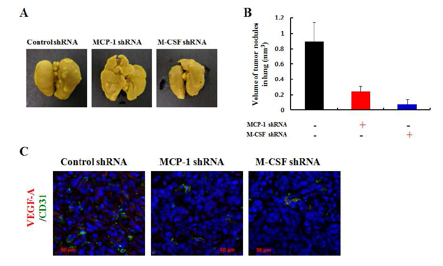MCP-1, M-CSF의 발현 억제에 의해 폐전이 및 신생혈관 생성이 억제됨.