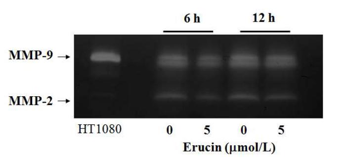 Erucin이 MDA-MB-231 세포의 MMP 활성에 미치는 영향.