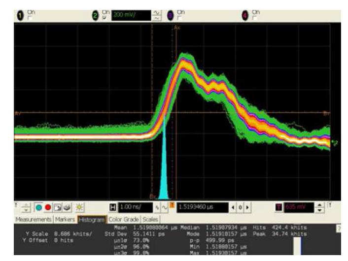 leading edge detection 의 jitter 측정