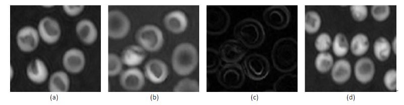 Fig. 6. Some characteristics of red blood cells quantitative phase image