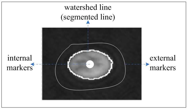 Fig. 9. An example of experimental results for marker-controlled watershed algorithm.