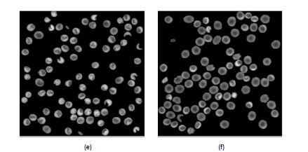 Fig. 11. RBC phase images