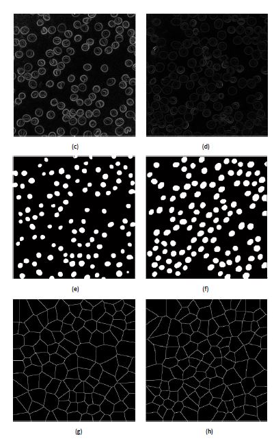 Fig. 12. Key steps of the proposed phase image segmentation