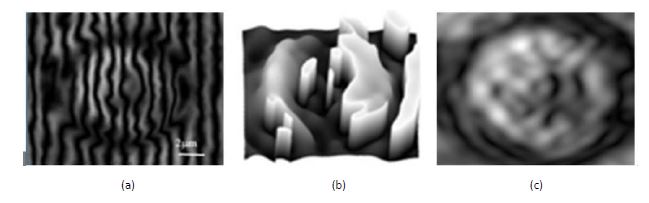 Fig. 28. (a, d) shearing interferograms. (b, e) RBC gradient phase image retrieved from shearing interferograms in (a) and (d), respectively. (c, f) RBC gradient amplitude image retrieved from shearing interferograms in (a) and (d) respectively. (a, b, c) are from a healthy RBC, while (d, e, f) are from a malaria infected RBC