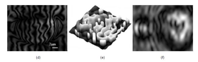 Fig. 28. (a, d) shearing interferograms. (b, e) RBC gradient phase image retrieved from shearing interferograms in (a) and (d), respectively. (c, f) RBC gradient amplitude image retrieved from shearing interferograms in (a) and (d) respectively. (a, b, c) are from a healthy RBC, while (d, e, f) are from a malaria infected RBC