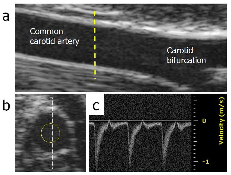 그림 31. Typical high-resolution ultrasound images of a rat common carotid artery in longitudinal view