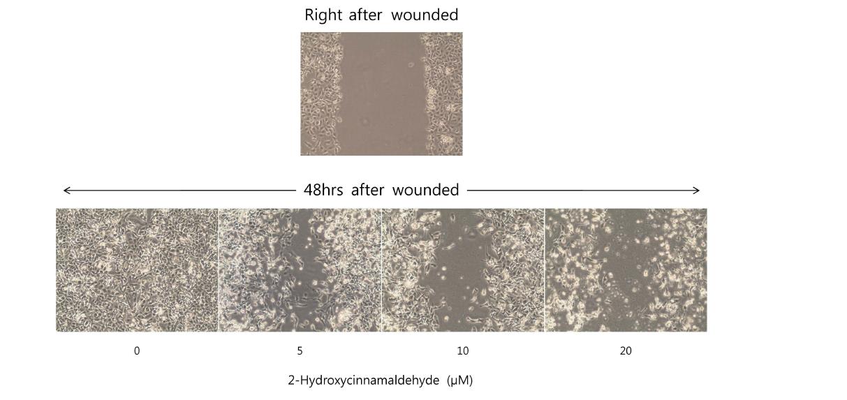 HT1080 세포주에서 2-hydroxycinnamaldehyde의 이동성 저해효능