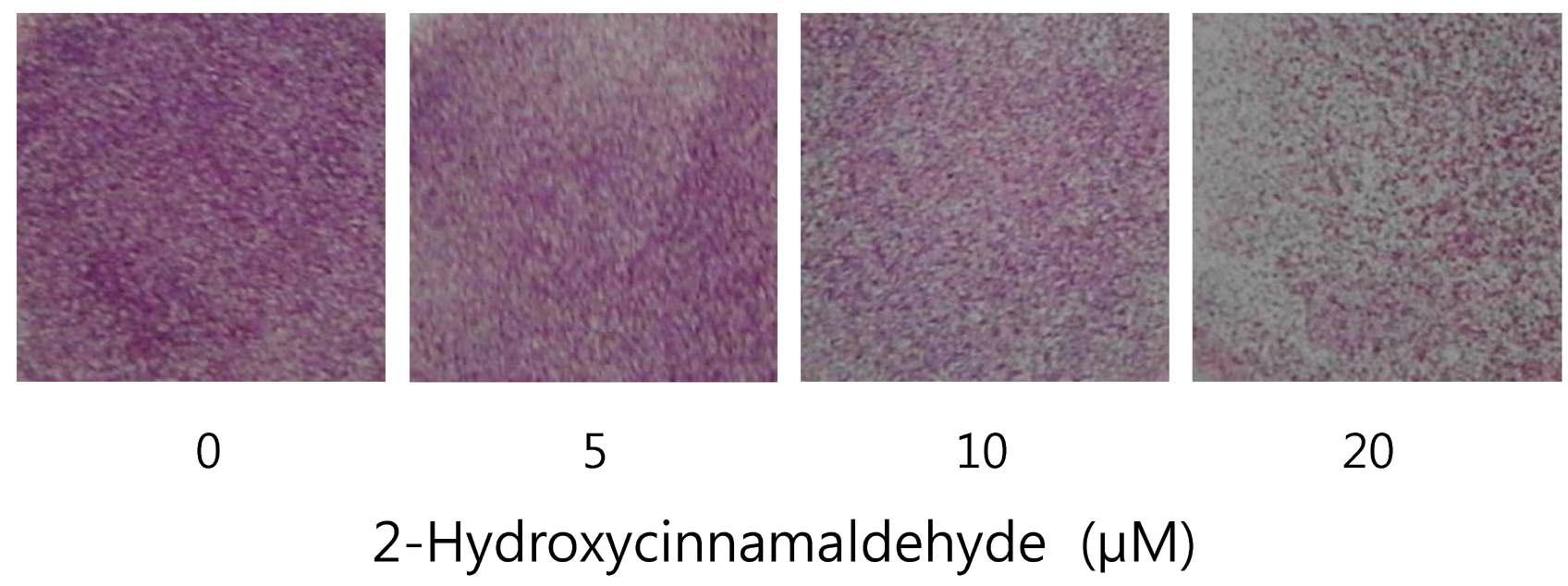 HT1080 세포주에서 2-hydroxycinnamaldehyde의 침윤성 저해 효능