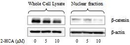 β-catenin의 핵 내로의 이행에 대한 2-hydroxycinnamaldehyde의 억제 활성