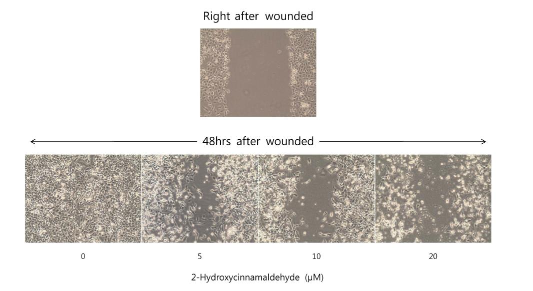 HT1080 세포주에서 2-hydroxycinnamaldehyde의 이동성 저해효능