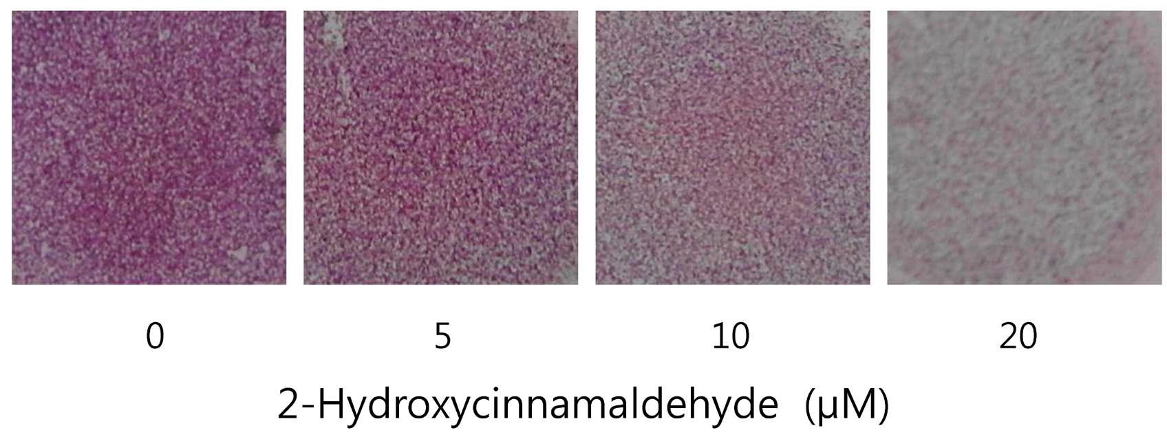 HT1080 세포주에서 2-hydroxycinnamaldehyde의 이동성 저해 효능