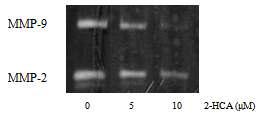 2-Hydroxycinnamaldehyde 처리에 의한 HT1080세포의 MMPs활성 감소