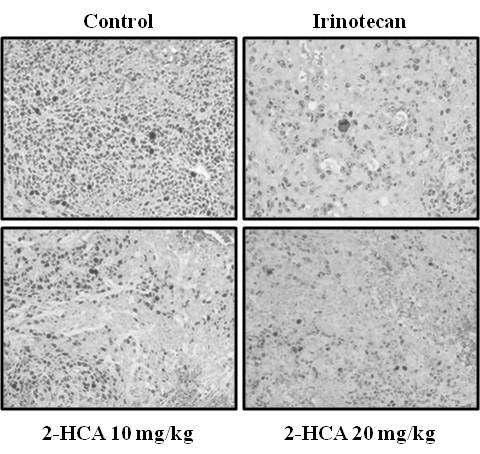 Tumor xenograft model에서 2-hydroxycinnamaldehyde에 의한 세포 증식 생체 지표 발현 억제 효능