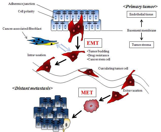 암전이에 있어 EMT 및 MET의 관련성
