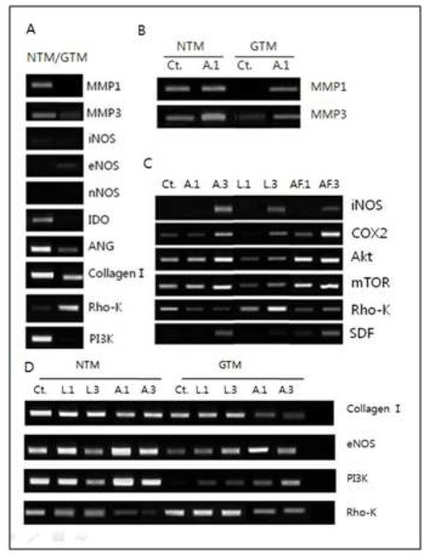 사람 섬유주 세포의 면역 - 방수 유출 관련 인자들의 RT-PCR 분석