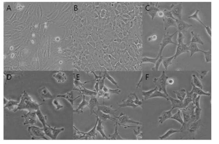 배양된 사람 섬유주세포의 형태적 차이