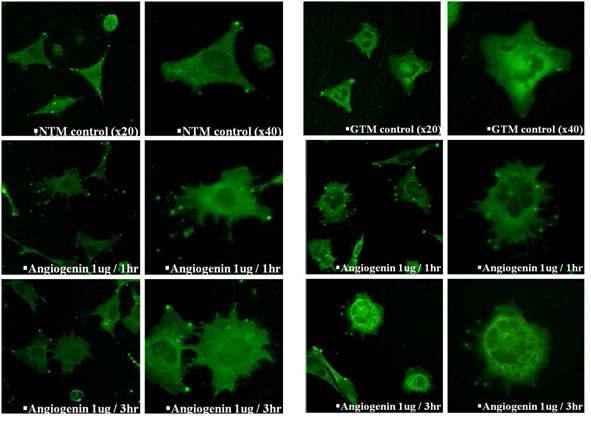 안지오제닌 처리 후 섬유주세포에서의 lamellipodia 형성 확인