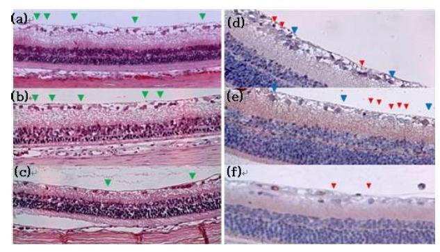 안압상승 모델에서 안지오제닌 투여군과 대조군의 망막신경절 세포 및 대식세포 변화
