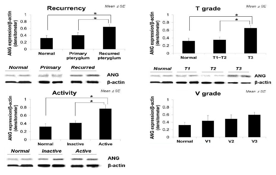 익상편 재발유무, 등급, 혈관화 정도 및 질병 활성도에 따른 FactorX(angiogenin) Western blot 분석 결과