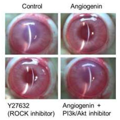 FactorX(angiogenin), ROCK inhibitor 투여군과 대조군에서의 각막 부종 호전 정도