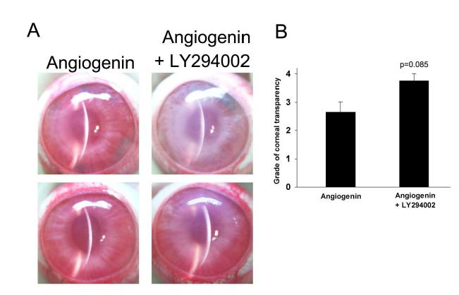 LY294002와 FactorX(angiogenin) 동반 처리 시 배양 각막 내피세포의 창상 회복 양상 분석