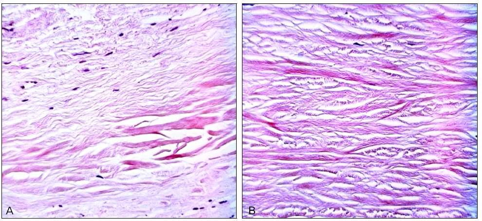 Lamella collagen fiber 로 구성된 A. 귀구슬 연골막 과 B. 인간 공막의 조직학적 유사성