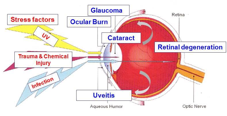 내, 외부적 스트레스에 의해 유발되는 각종 안구 면역 질환