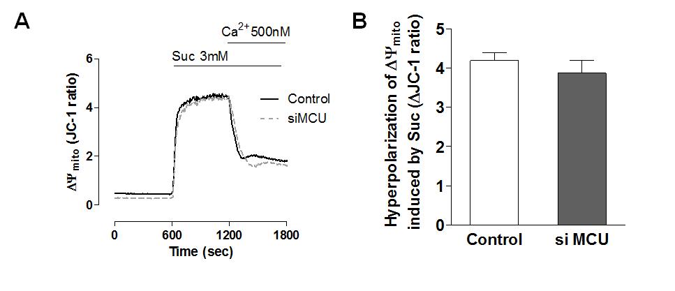 Permeabilized cell에서 MCU 발현양 조절에 따른 미토콘드리아 막전압 변화