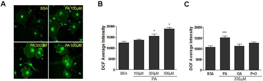 포화유리지방산에 의한 세포내 활성산소 생성 증가 (PA; palmitate, OA; oleate)