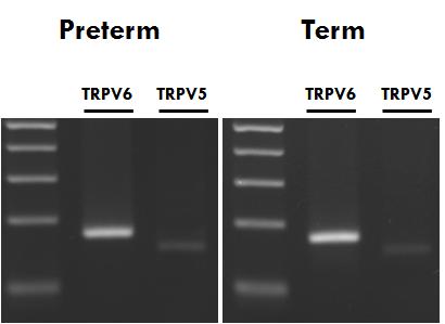 조산 산모와 만삭 분만 산모의 태반에서 TRPV6와 TRPV5의 발현 양 비교