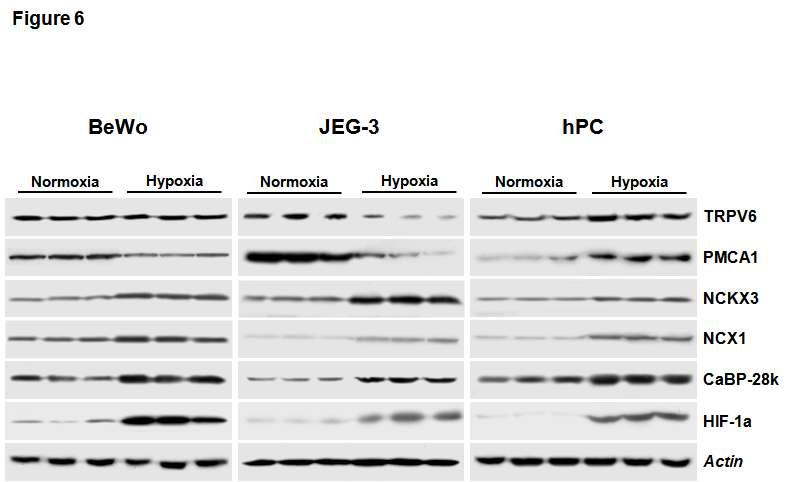 저 산소 조건에서 태반세포 (hPC)와 융모암세포(BeWo, JEG3)의 칼슘 관련 단백질들의 발현
