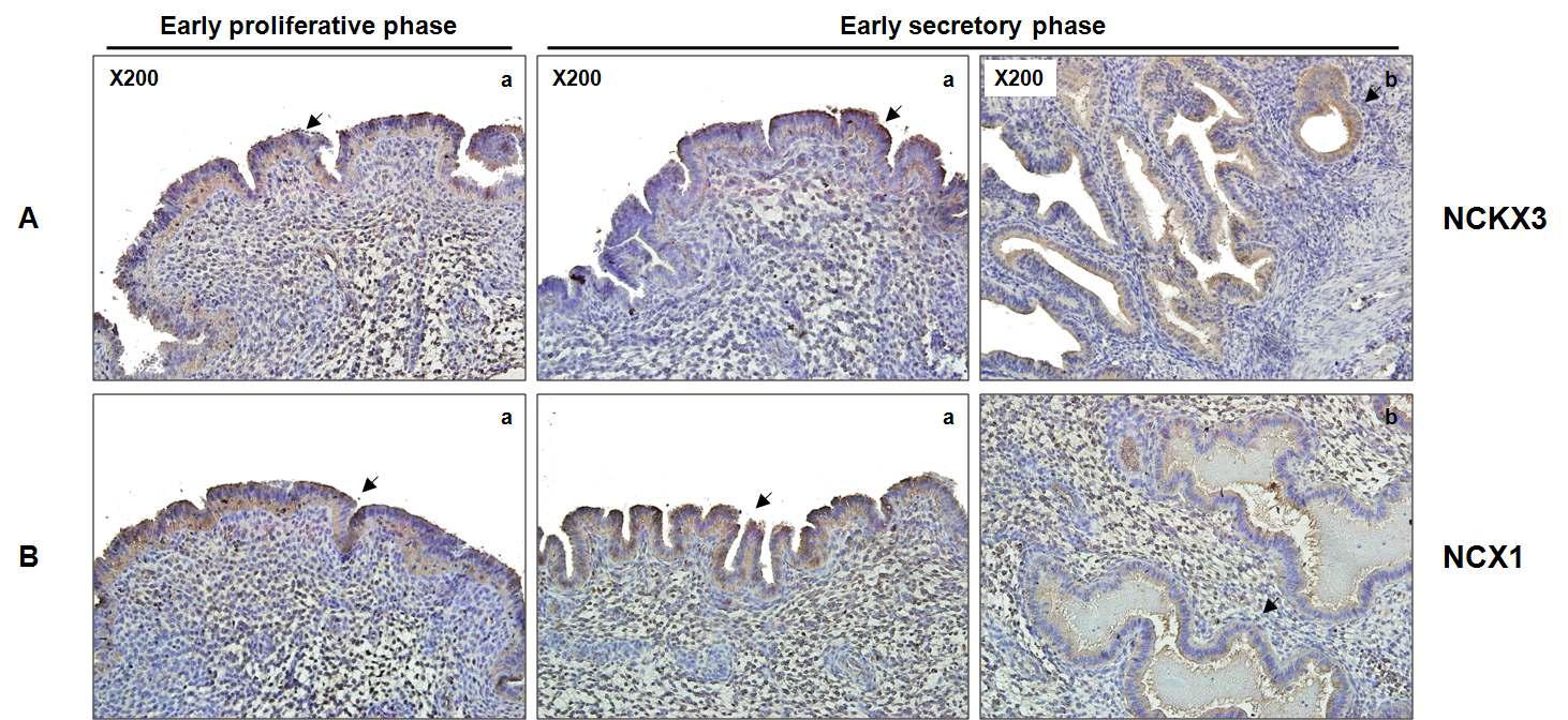 성주기별 여성의 자궁내막에서의 NCKX3와 NCX1의 발현 위치 확인