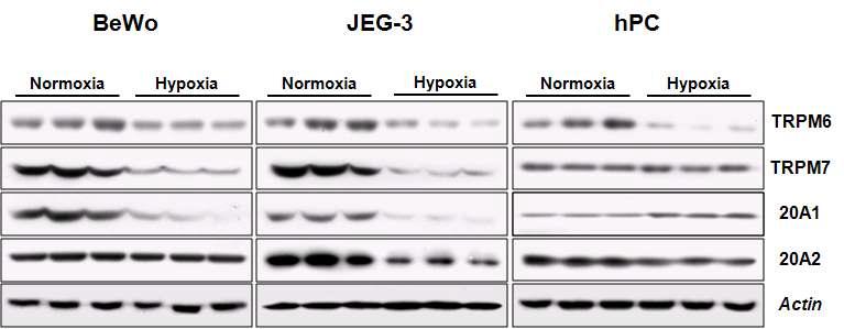 저산소 스트레스가 동반된 태반세포(BeWo, JEG3, hPC)에서의 마그네슘 및 무기인 채널 유전자들의 단백질 발현 분석