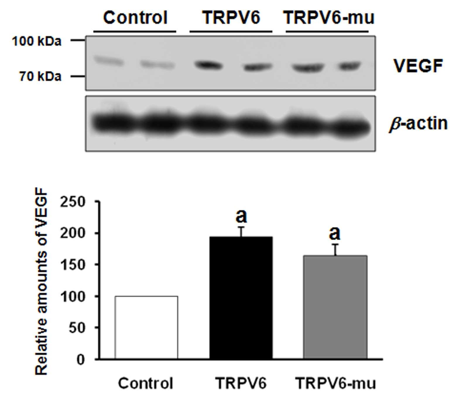 태반세포(BeWo)에서 TRPV6 과발현에 의한 VEGF 발현