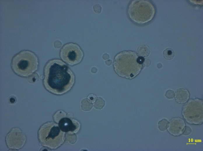 Raw C. glutamicum의 현미경 관찰사진