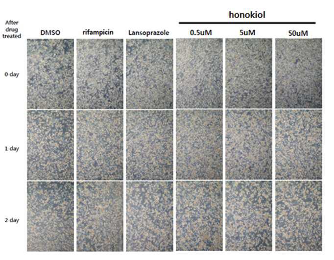 사람 hepatocytes HF382에서 honokiol 처리