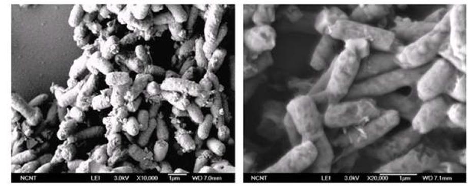 SEM pictures of the bacteria film before cleaning