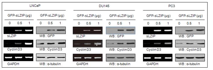 전립선암 세포주에서 sLZIP에 따른 cyclin D3 발현 증가