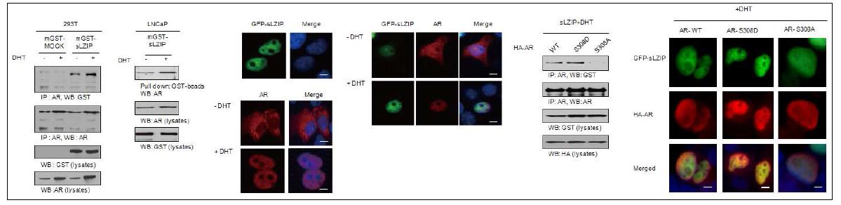 sLZIP이 AR과 결합함. 특히, cyclin D3/CDK11p58에 의해 Ser308 부위가 인산화된 AR과 복합체를 형성하여 AR의 co-repressor로 작용함.