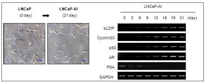 안드로겐 의존적에서 비의존적 전립선암으로 전환되면서 sLZIP과 cyclin D3의 발현량이 증가함