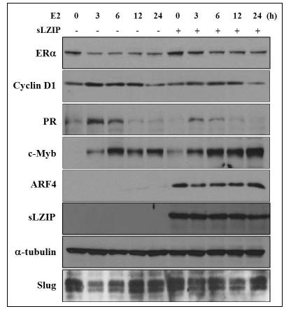 MCF7 세포주에서 sLZIP 도입과 리간드의 시간적 처리에 따른 ER target 유전자의 발현양