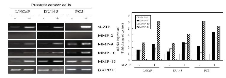 전립선암세포주에서 sLZIP 과발현시 MMP-9, -10, -13의 mRNA 레벨이 증가됨(좌)과 증가한 mRNA 레벨을 표로 나타낸 결과 (우).