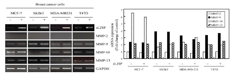 유방암세포주에서 sLZIP 과발현시 MMP-10, MMP-13의 mRNA레벨이 증가되는 것을 확인한 결과(좌)와 증가한 mRNA레벨을 표로 나타낸 결과 (우).