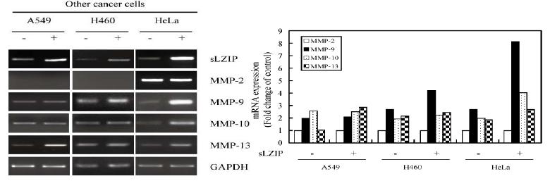 폐암세포주와 자궁경부암세포주에서 sLZIP과발현시 세포외 기질 분해효소들(MMP-9, MMP-10, MMP-13)의 mRNA가 증가되는 것을 확인한 결과 (좌)와 증가한 mRNA레벨을 표로 나타낸 결과 (우).