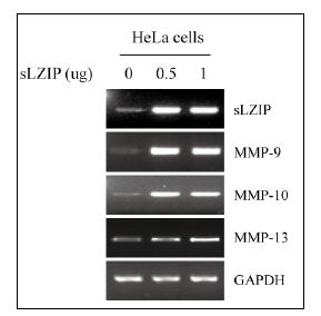 자궁경부암세포주에서 sLZIP 과발현시 MMP-9, -10, -13)의 mRNA 레벨 증감