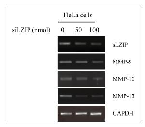 자궁경부암세포주 에서 sLZIP을 knock down 에서 sLZIP 과발현시 시 MMP-9, -10, -13)의 mRNA 레벨의 증감