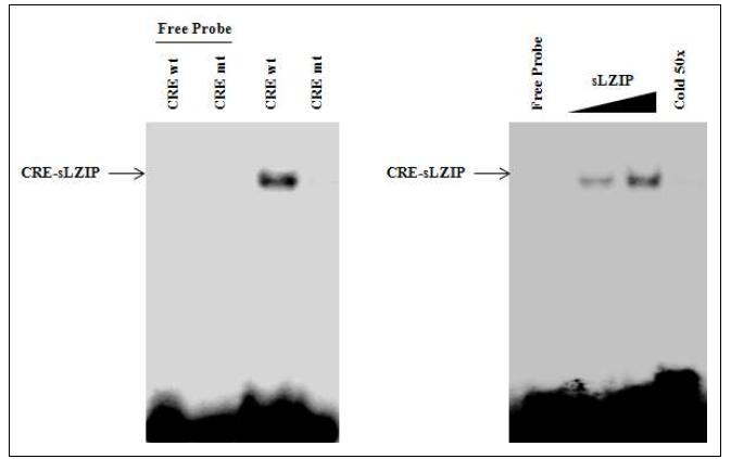 sLZIP이 PEPCK 유전자 프로모터내 CRE부위에 직접적으로 결합함을 확인한 결과와 sLZIP 발현량에 따라 결합이 증가함.