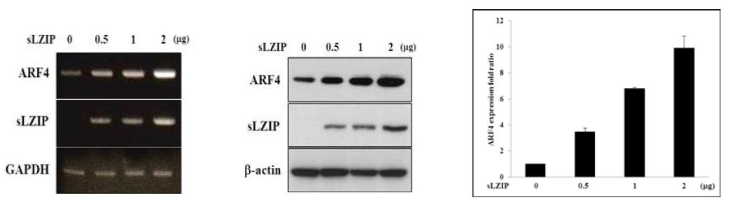 LNCaP 세포주에서 sLZIP 도입에 따른 ARF4의 mRNA 수준, 단백질 수준 확인