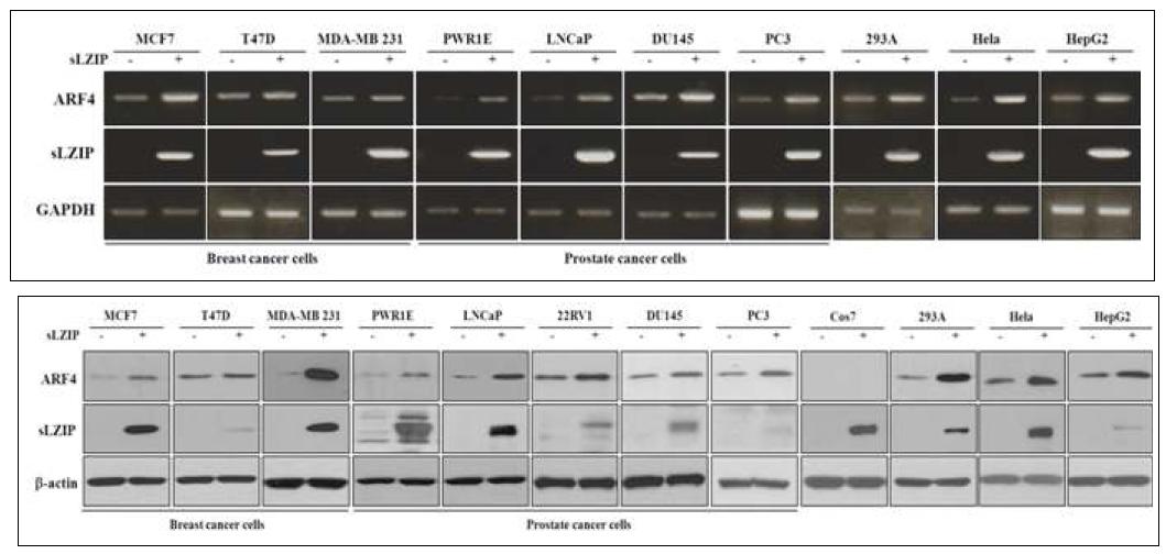 다양한 세포주에서의 sLZIP 도입에 따른 ARF4의 mRNA 수준, 단백질 수준 확인